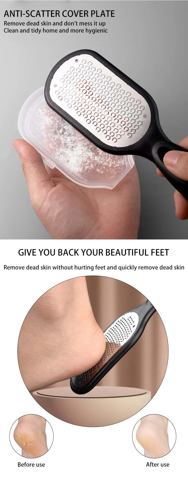 Professionele Voetvijl van Roestvrij Staal – Eeltverwijderaar & Dode Huid Verwijderaar | Pedicure Tool voor Gladde Voeten